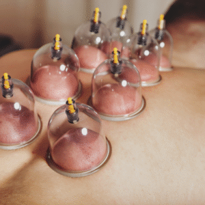 Blood Cupping | 15min
